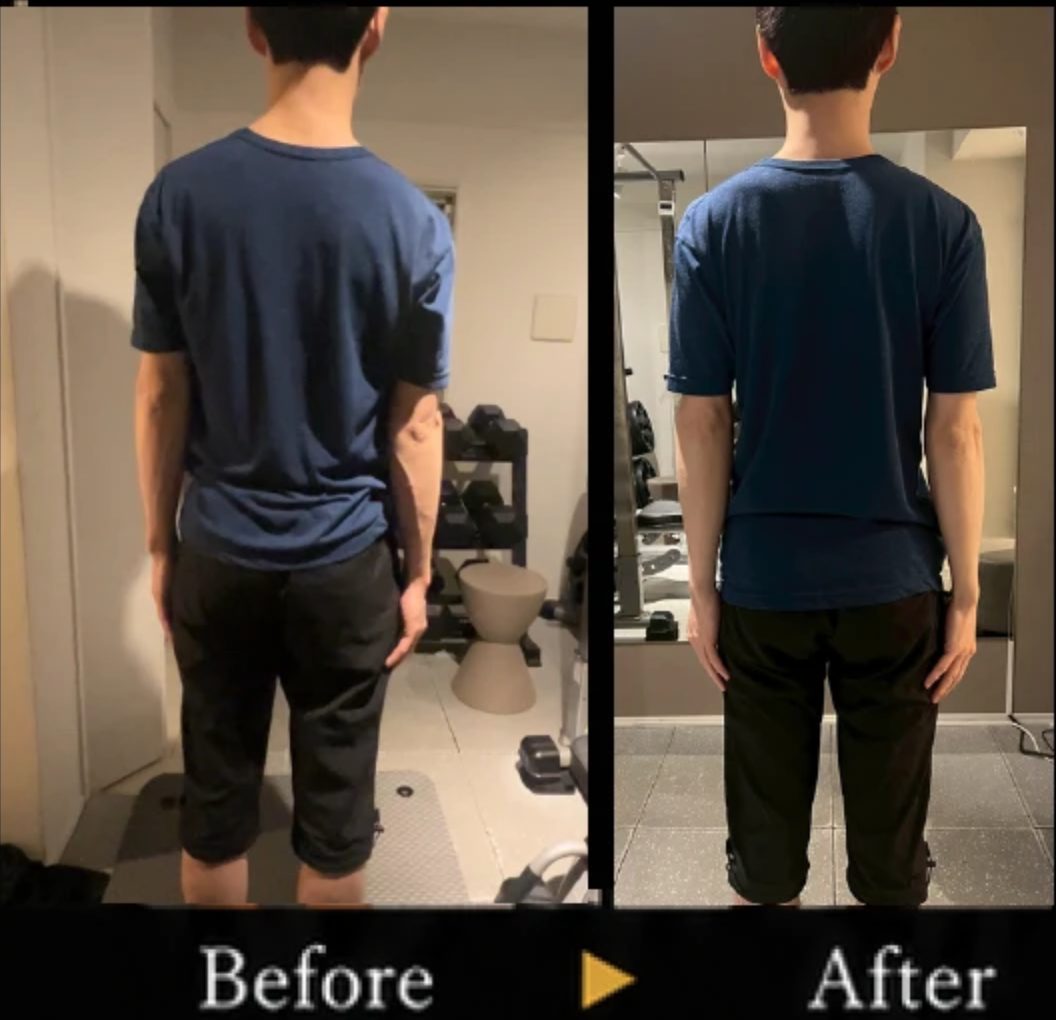 柔軟性・可動域向上のBefore After